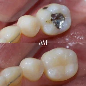 Home piorro quisquam